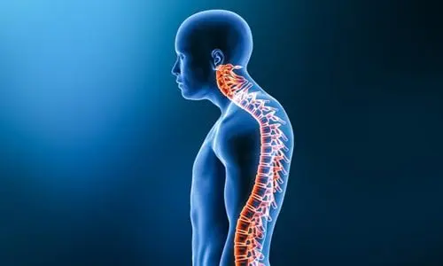 Ameliyatsız Kamburluk (Kifoz) Tedavisi